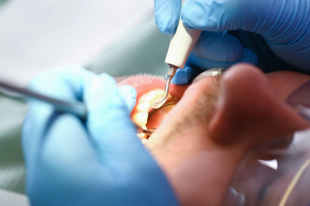 Best Emergency Denture Repair in Pinehurst, MA